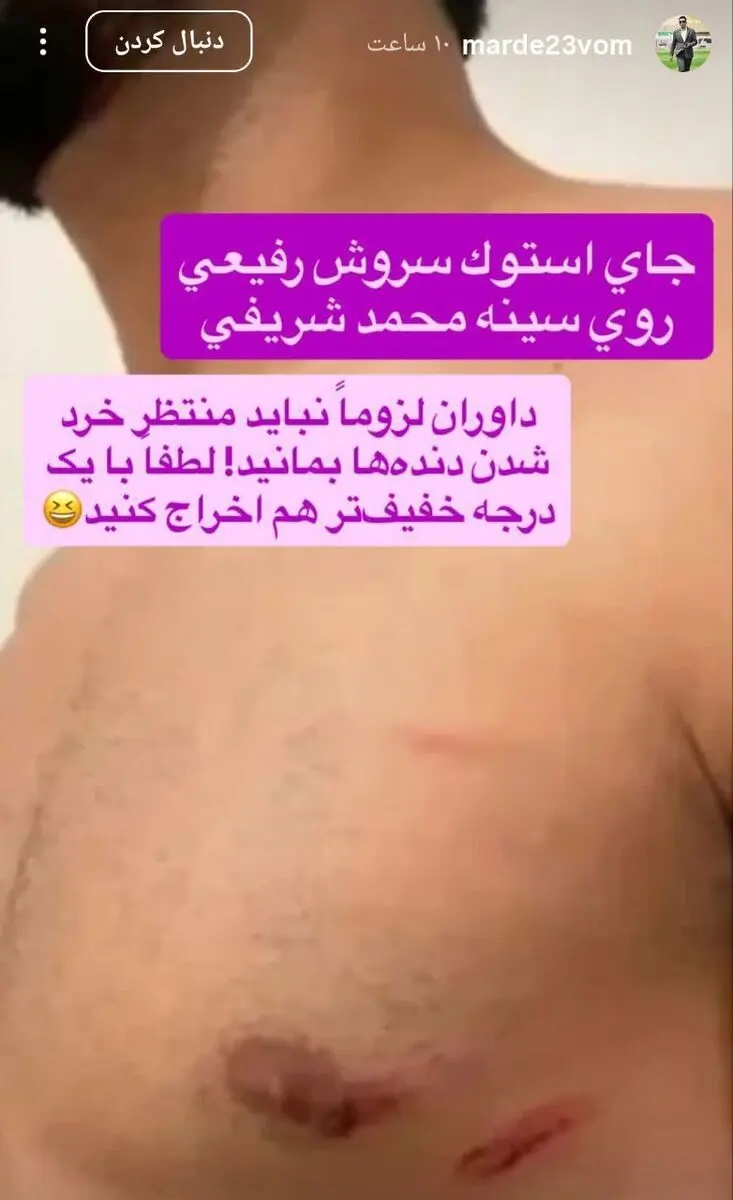 جای استوک سروش رفیعی روی سینه بازیکن استقلال خوزستان