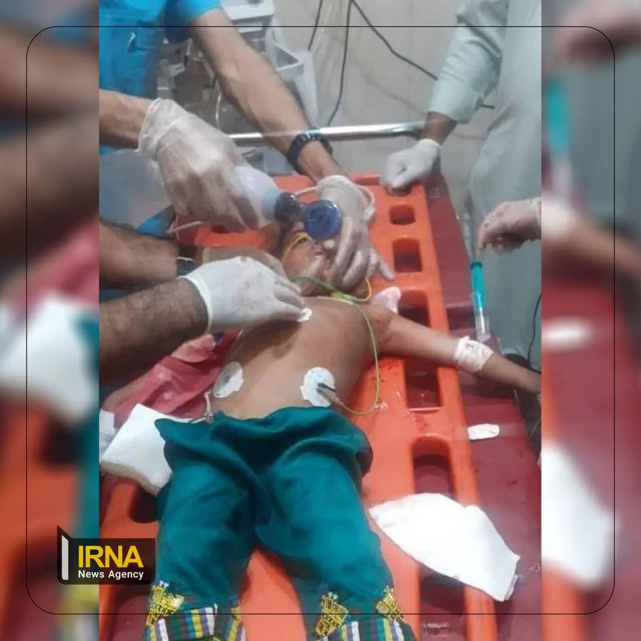 کودک مجروح‌شده در حملات تروریستی گروهک جیش‌الظلم