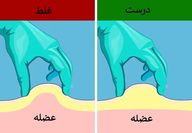  آمپول زدن در خانه؛ چطور مثل حرفه‌ای‌ها آمپول بزنیم؟!