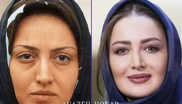 شیلا خداداد را با این چهره پیر نمی‌شناسید