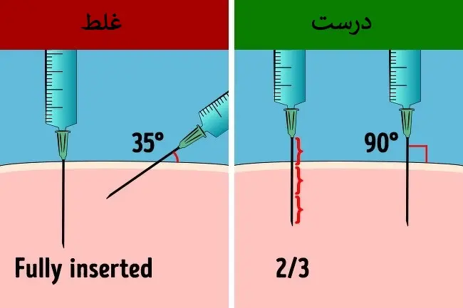  آمپول زدن در خانه؛ چطور مثل حرفه‌ای‌ها آمپول بزنیم؟!