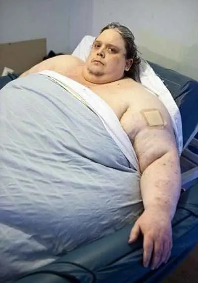 چاق ترین آدم دنیا با وزن 370 کیلوگرم