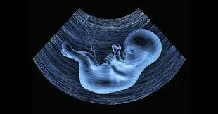 غربالگری جنین ممنوع نیست/ برخورد با پزشکان متخلف در سقط جنین