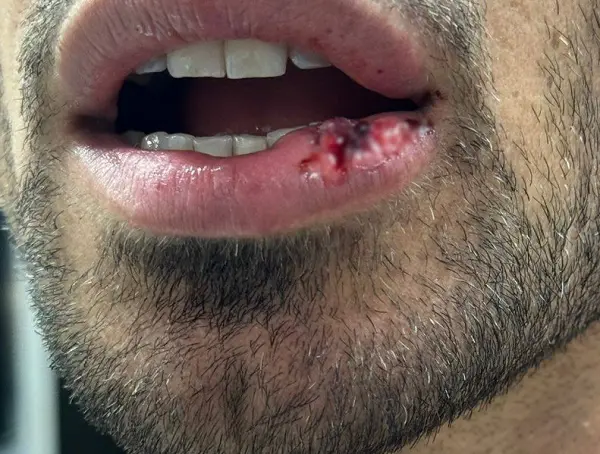 محمدی کاپیتان تراکتور را زخمی کرد