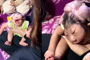 تولد نوزاد عجیب الخلقه که شما را شوکه می کند