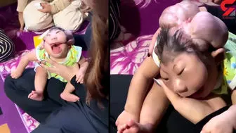 تولد نوزاد عجیب الخلقه که شما را شوکه می کند