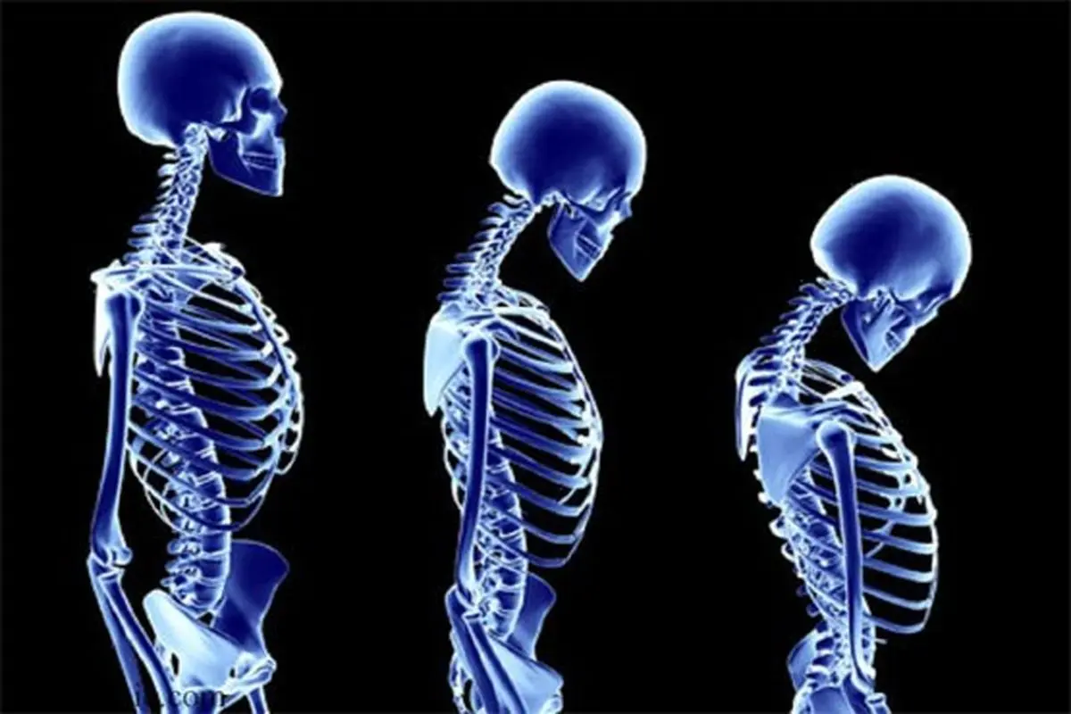 کاهش قد را جدی بگیرید،یک نشانه است!