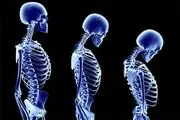 کاهش قد را جدی بگیرید،یک نشانه است!