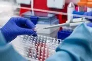 تاثیر نمونه گیری در نتیجه تست کرونا
