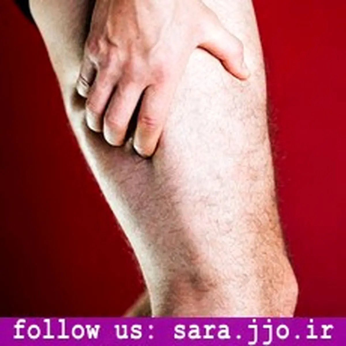 سیاتیک چیست و چه علائمی دارد؟
