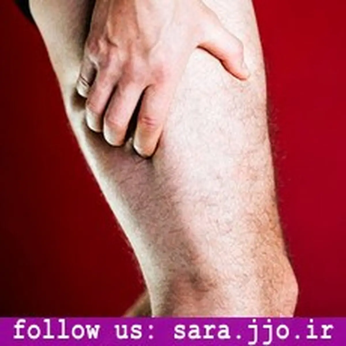 سیاتیک چیست و چه علائمی دارد؟
