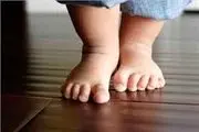به شکل پای کودکان خود توجه کنید