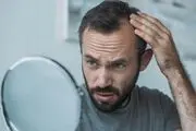 آیا افسردگی باعث ریزش مو میشود ؟ 