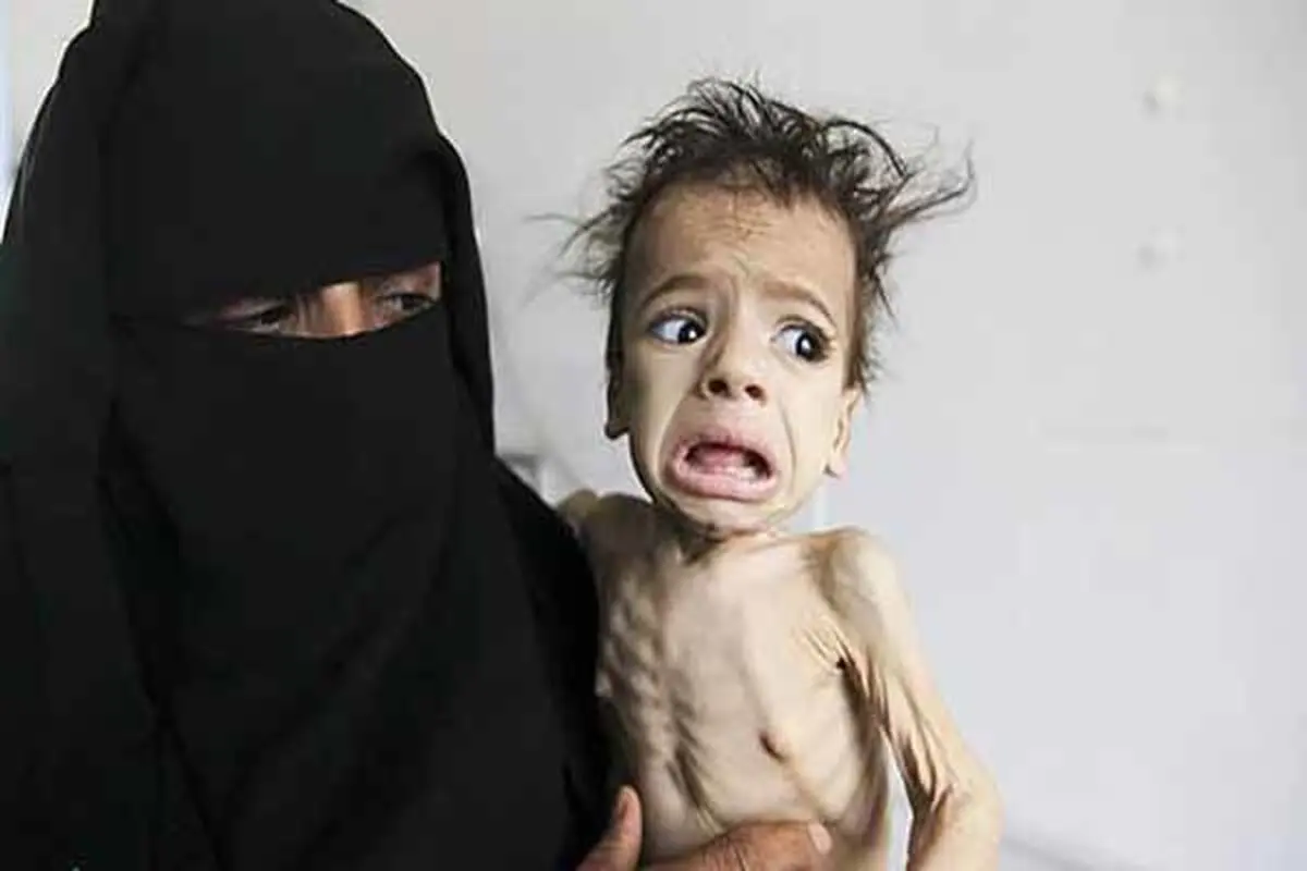  سازمان ملل خواستار توقف سریع جنگ در یمن شد