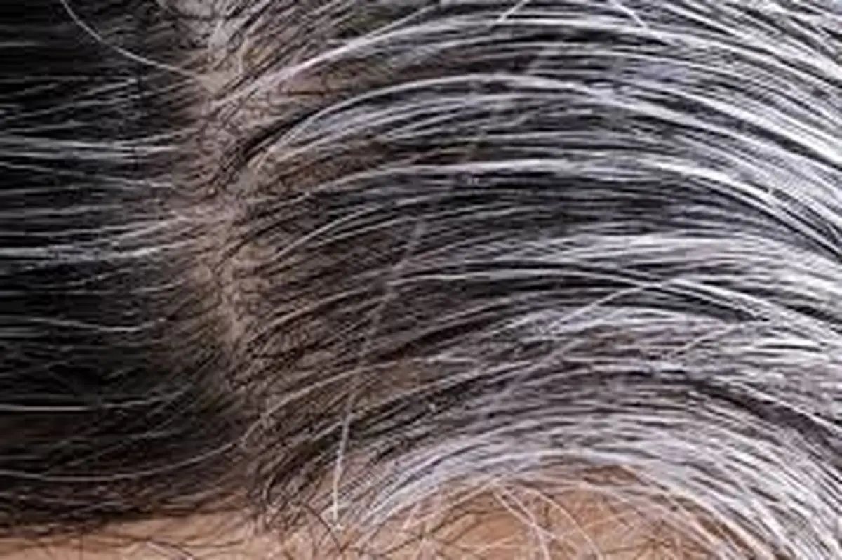 آیا واقعا مو یک شبه سفید میشود؟