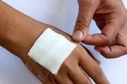 کنترل عفونت زخم با فناوری‌های جدید
