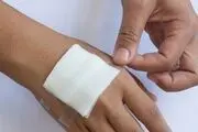 کنترل عفونت زخم با فناوری‌های جدید
