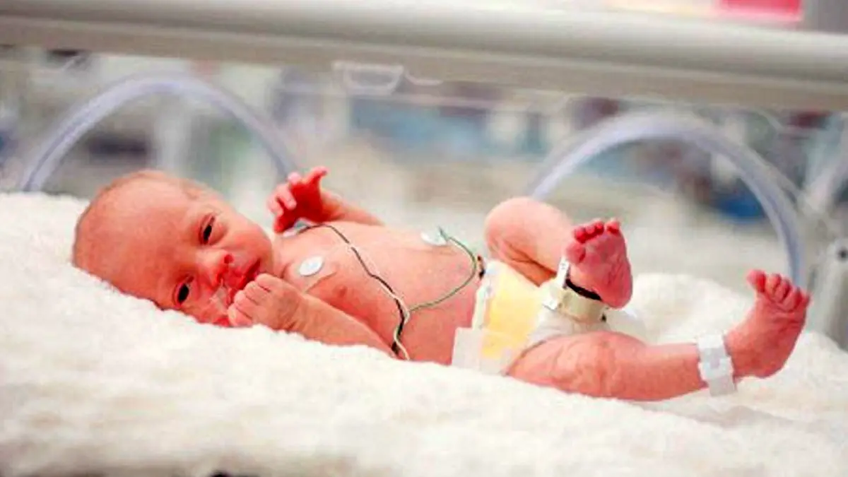 ترافیک در تولد نوزاد کم وزن نقش دارد؟
