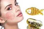 علایمی که نشان می دهد به مصرف امگا 3 نیاز داریم
