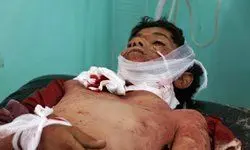37 نفر از روزه داران یمنی کشته یا زخمی شدند/ عکس
