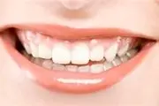 دندان قروچه چیست؟