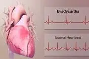 آریتمی قلبی چیست و چگونه درمان می‌شود؟!