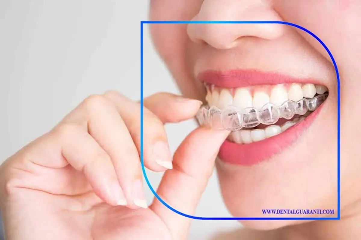 قالب‌گیری سنتی یا دیجیتال؟