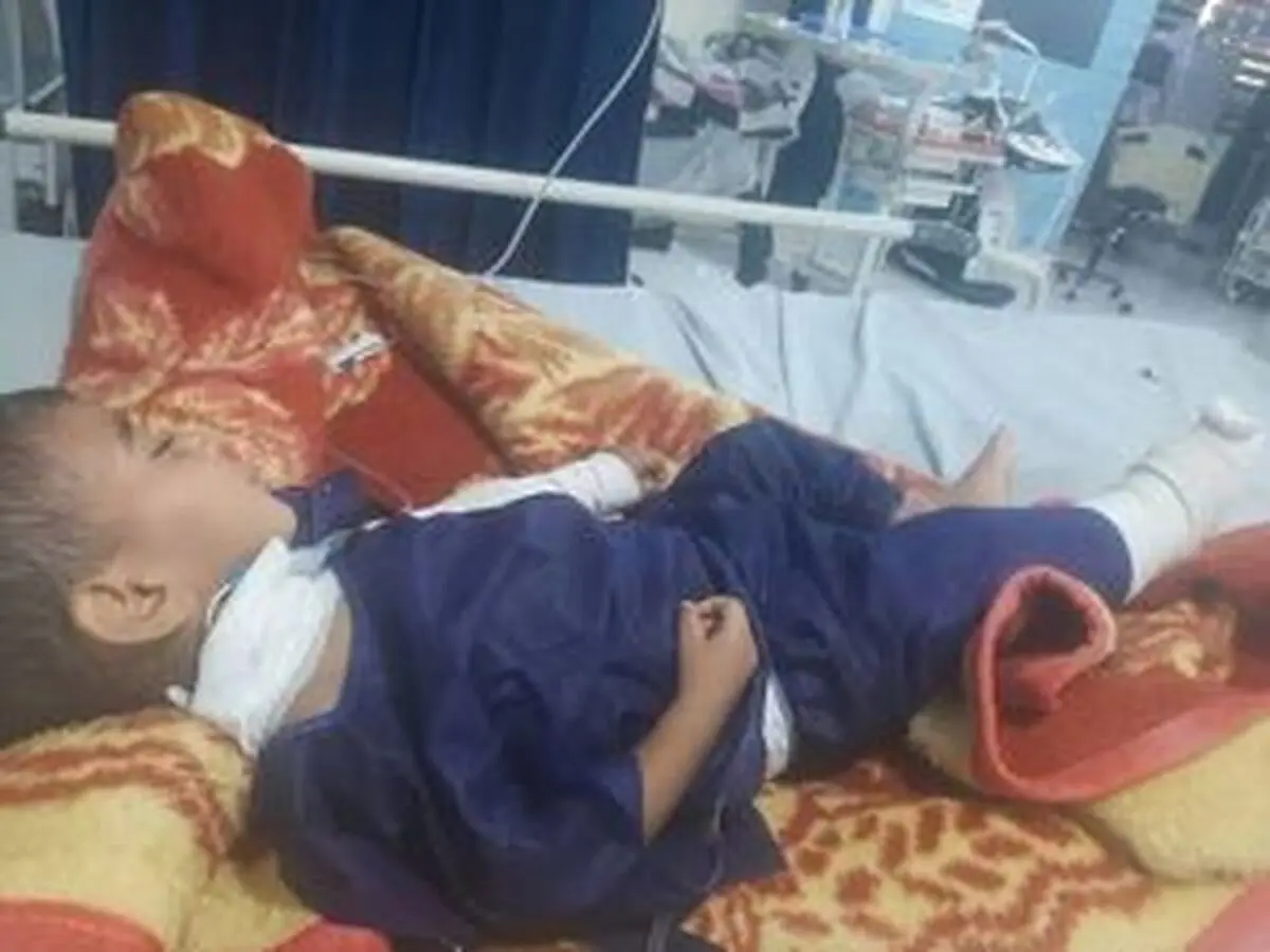کودک مجروح شده در حمله بامدادی به بندرعباس