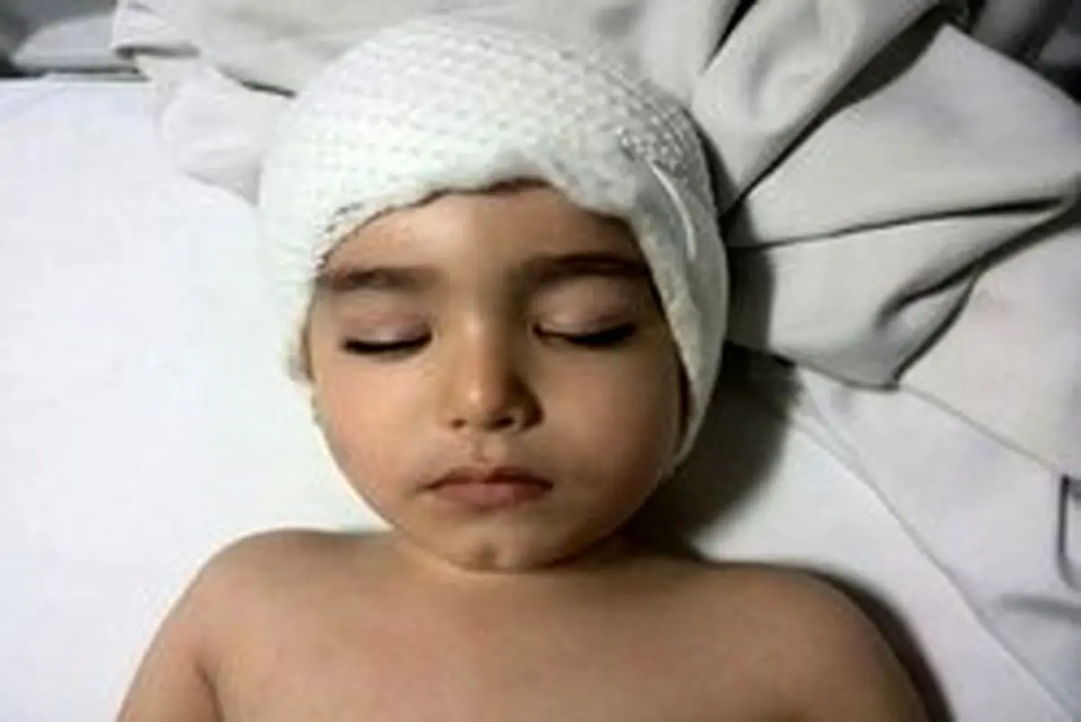 ناایمن بودن وسایل بازی کودک را ضربه مغزی کرد +عکس