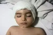  ناایمن بودن وسایل بازی کودک را ضربه مغزی کرد +عکس 