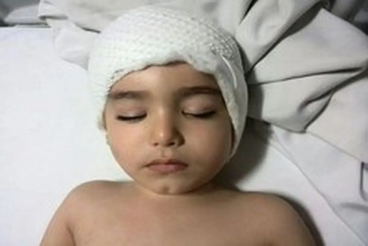  ناایمن بودن وسایل بازی کودک را ضربه مغزی کرد +عکس 