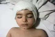  ناایمن بودن وسایل بازی کودک را ضربه مغزی کرد +عکس 