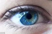 درمان نابینایی باتولیدبافت شبکیه چشم ازسلول‌های بنیادی