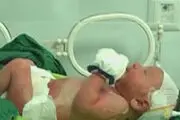 هشدار به مادران باردار/از صدای بلند دوری کنید