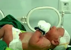 ماجرای نوزاد پرحاشیه بیمارستان صومعه سرا از زبان پدر/فیلم 