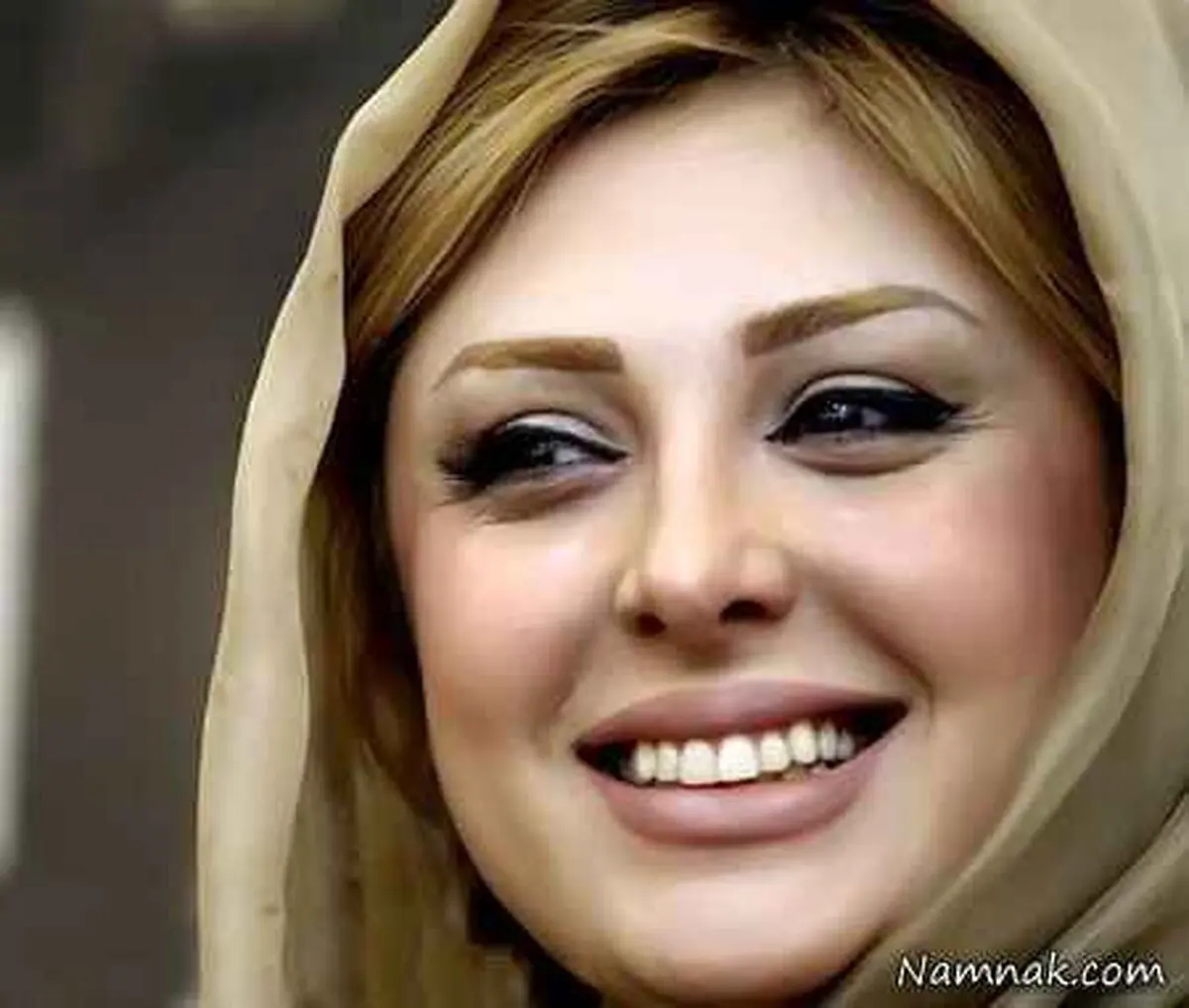 «نیوشا ضیغمی» مرد شد!
