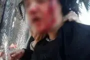 ضرب و شتم پناهجویان افغانستانی توسط پلیس ترکیه