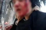ضرب و شتم پناهجویان افغانستانی توسط پلیس ترکیه
