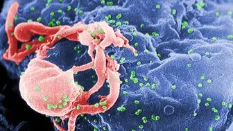 افزایش سرعت پیری در افراد مبتلا به ویروس اچ آی وی
