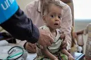 مرگ‌ومیر ناشی از وبا در یمن نسبت به سال گذشته ۹ برابر شده است! 