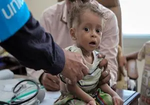 مرگ‌ومیر ناشی از وبا در یمن نسبت به سال گذشته ۹ برابر شده است! 