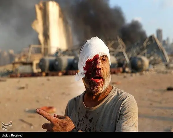 image17
