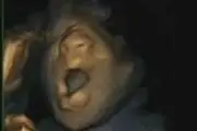 خمیازه جنین در رحم مادر + عکس