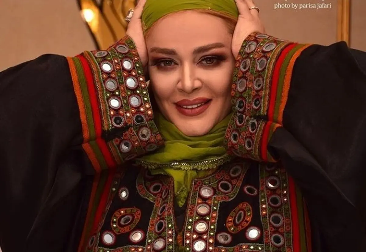 چهره دگرگون شده «بهاره رهنما»/ عکس