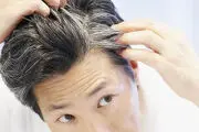 چگونه از ریزش مو جلوگیری کنیم؟