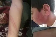 تنبیه بدنی دانش آموزان در مدارس همچنان ادامه دارد