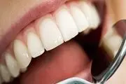 چند راهکار ساده خانگی برای سفید کردن دندان ها