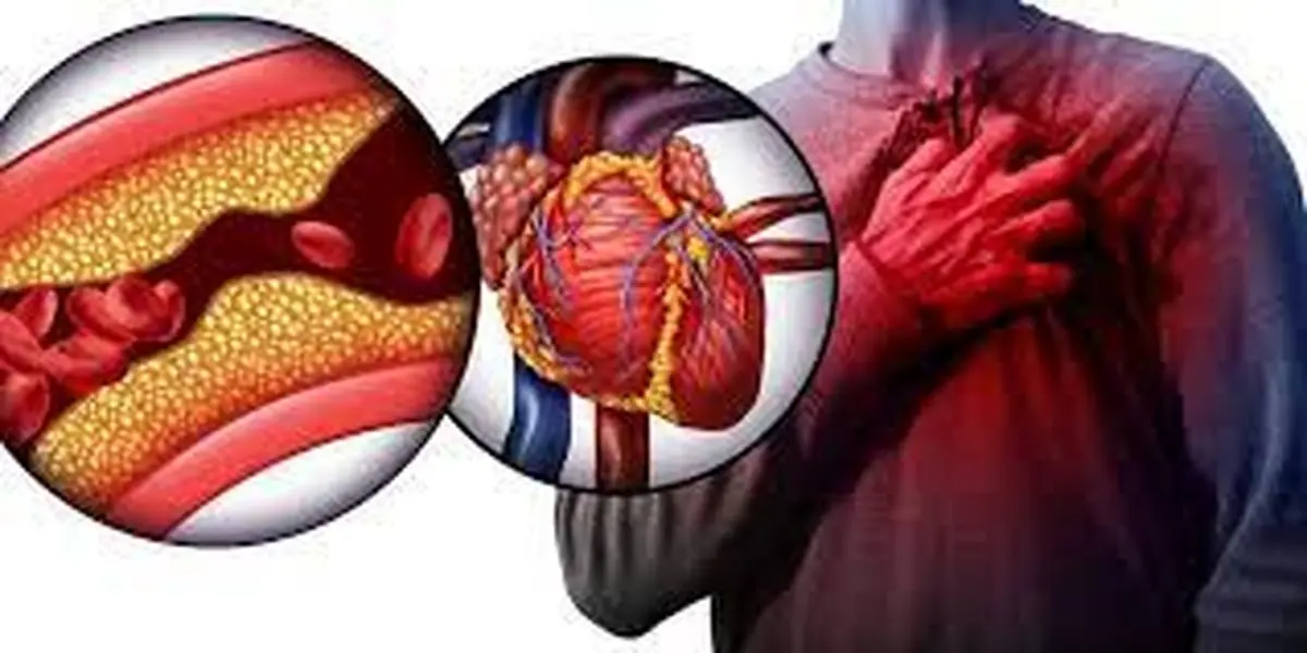 این خوراکی بدبو کلسترول خون را پایین می‌آورد!