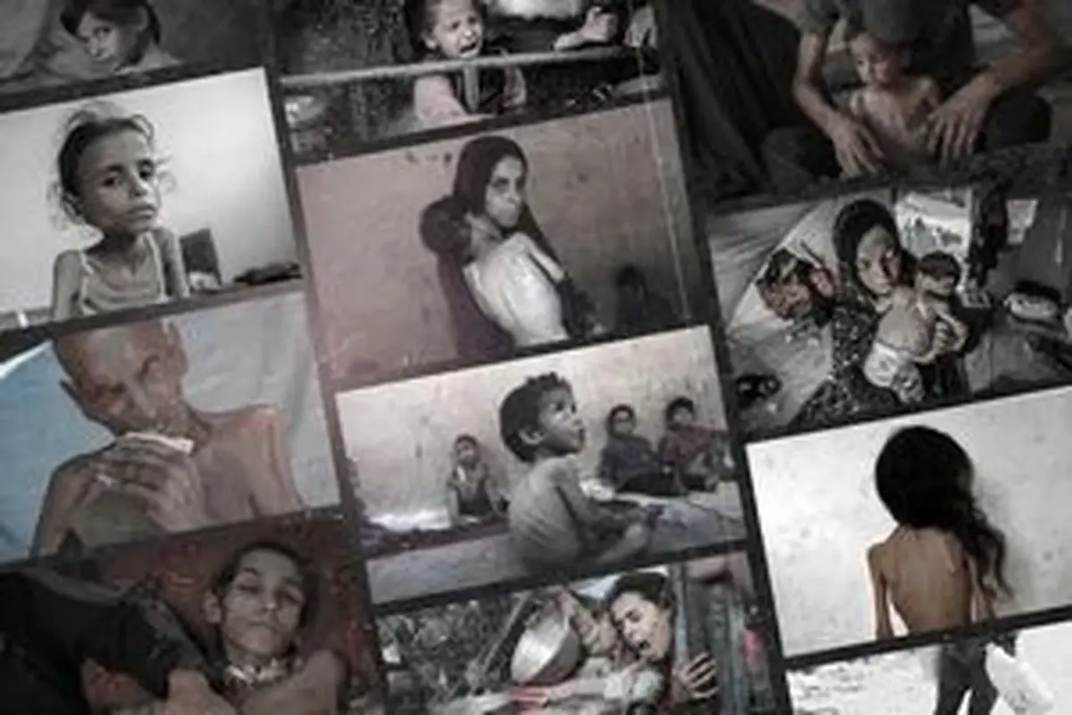 ادامه کابوس گرسنگی در غزه با پوشش آتش‌بس