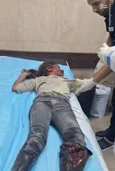 کودک کشی رژیم صهیونیستی در غزه